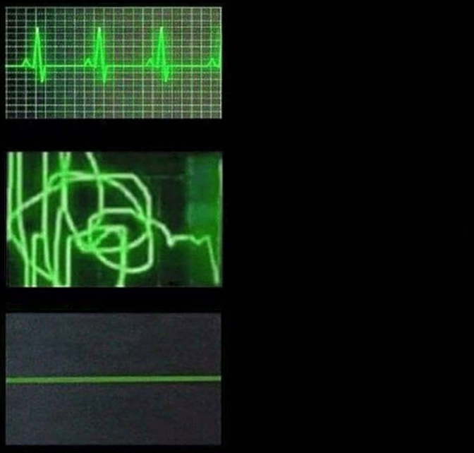 Heartbeat Empty Template  meme template